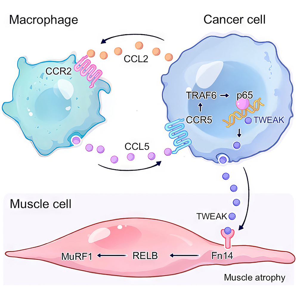 cancer cachexia - copyright ..